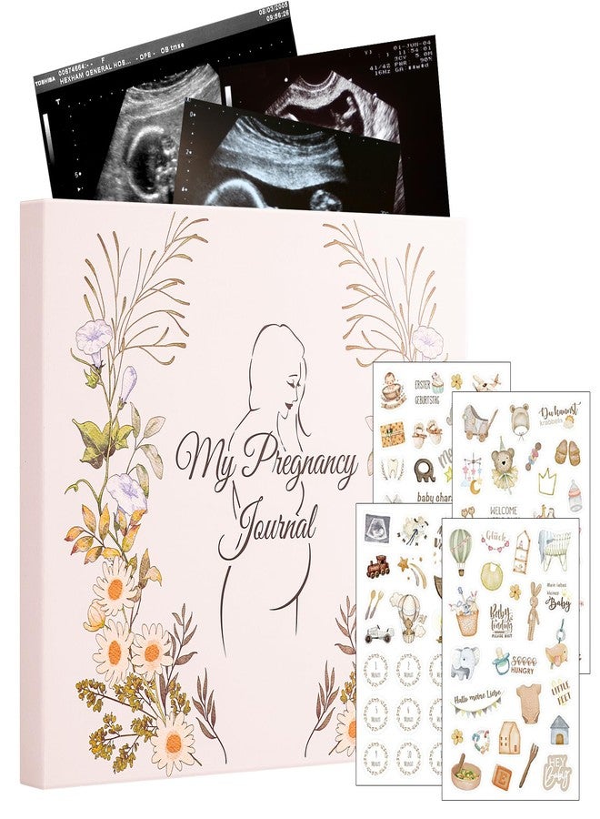 VinTS Pregnancy Journal,Pregnancy Baby Book for First Time Moms,135 Pages Hard Cover Pregnancy Memory Book With Stickers for First Time Mom to Be,Expecting Women - Image 1